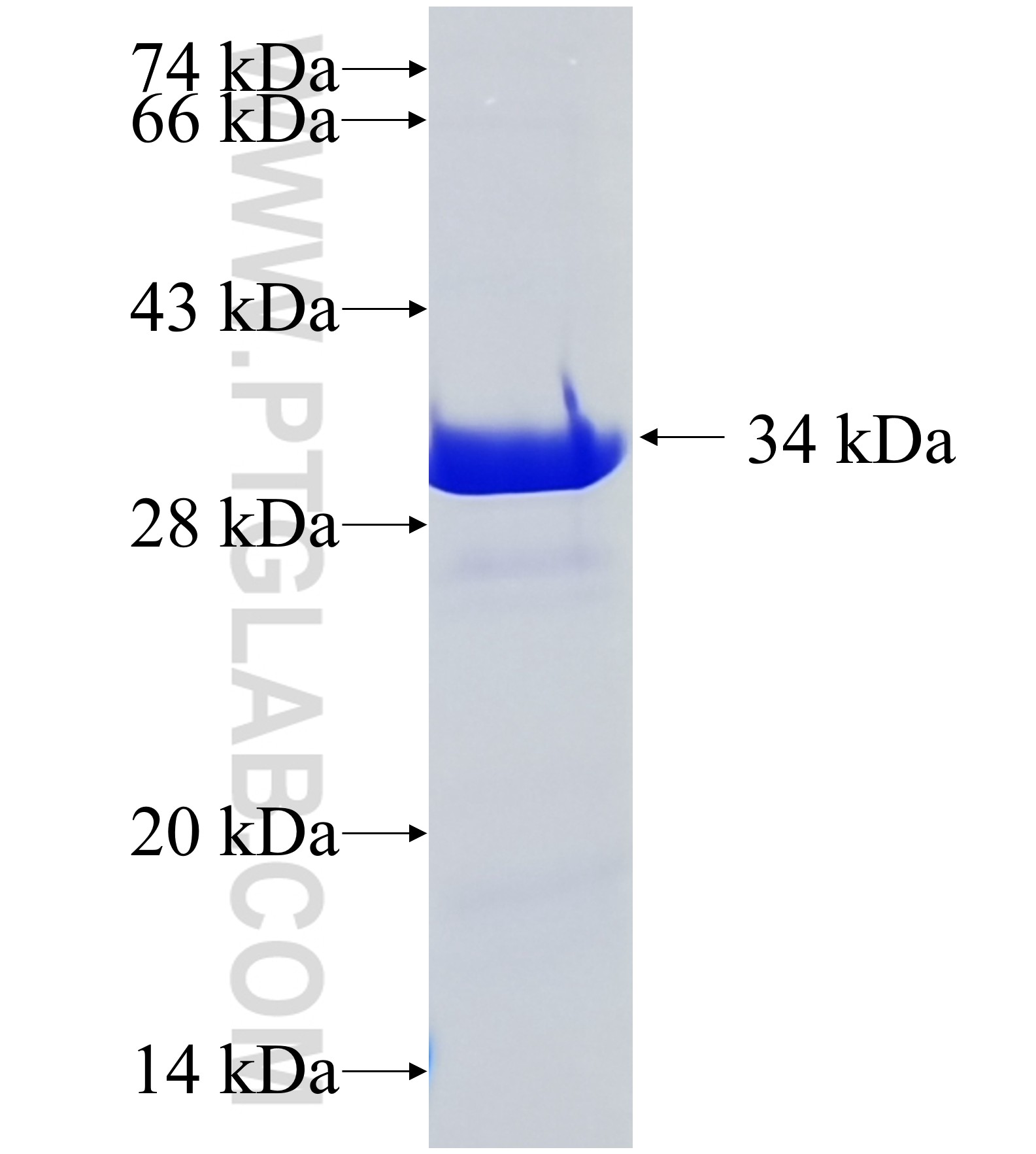 KIAA1715 fusion protein Ag37220 SDS-PAGE KIAA1715 fusion protein Ag37220 SDS-PAGE