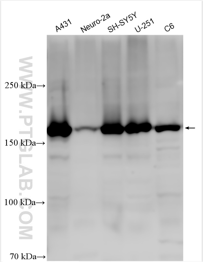WB analysis using 30140-1-AP