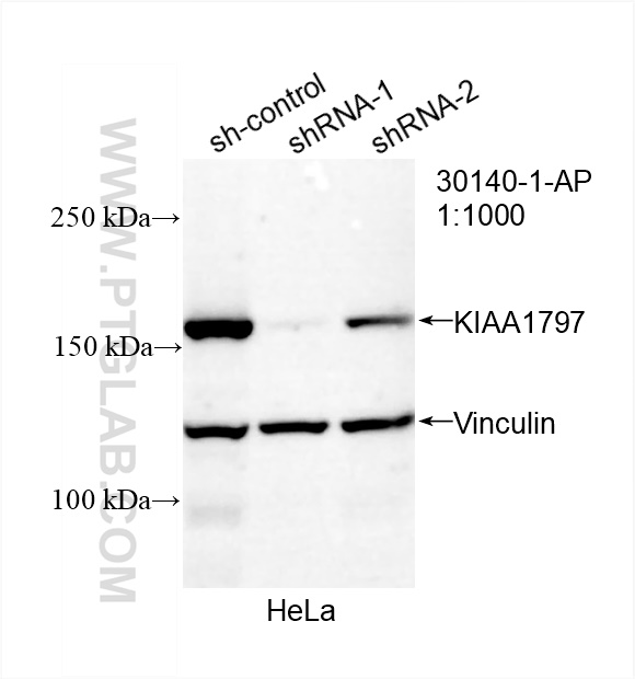 WB analysis of HeLa using 30140-1-AP