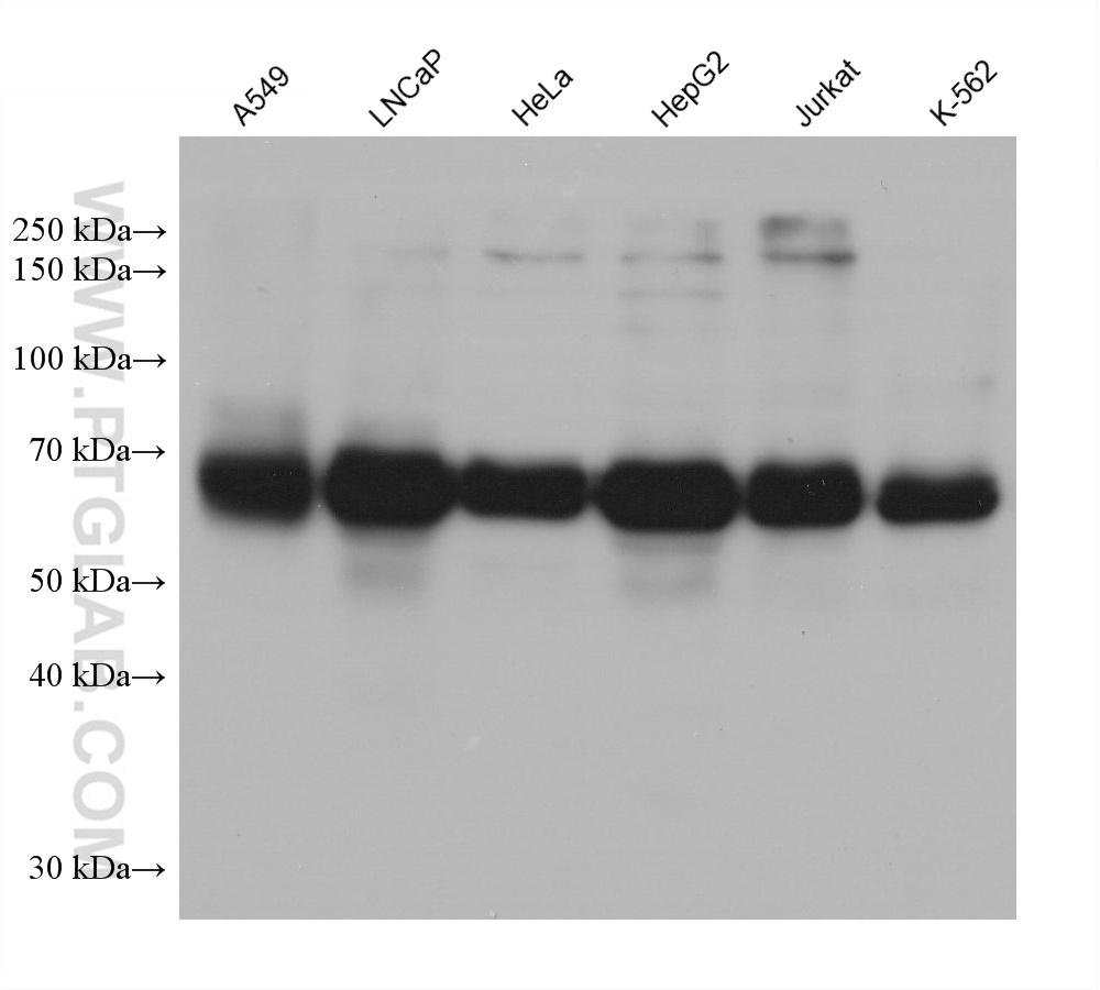 WB analysis using 68245-1-Ig