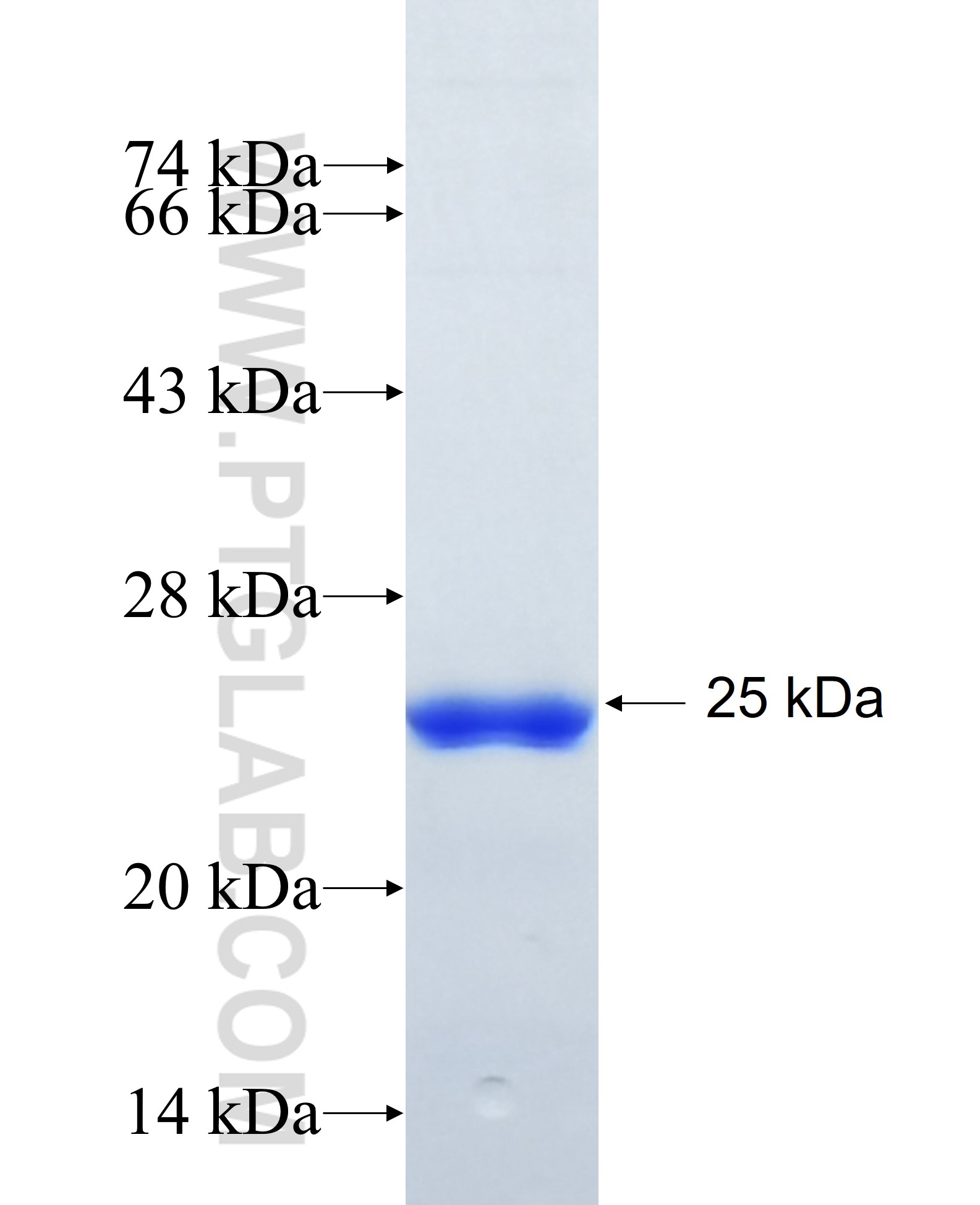 KIBRA fusion protein Ag27164 SDS-PAGE KIBRA fusion protein Ag27164 SDS-PAGE