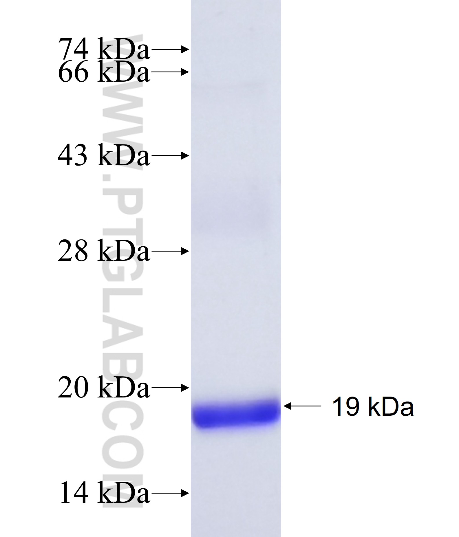 KIBRA fusion protein Ag41719 SDS-PAGE KIBRA fusion protein Ag41719 SDS-PAGE