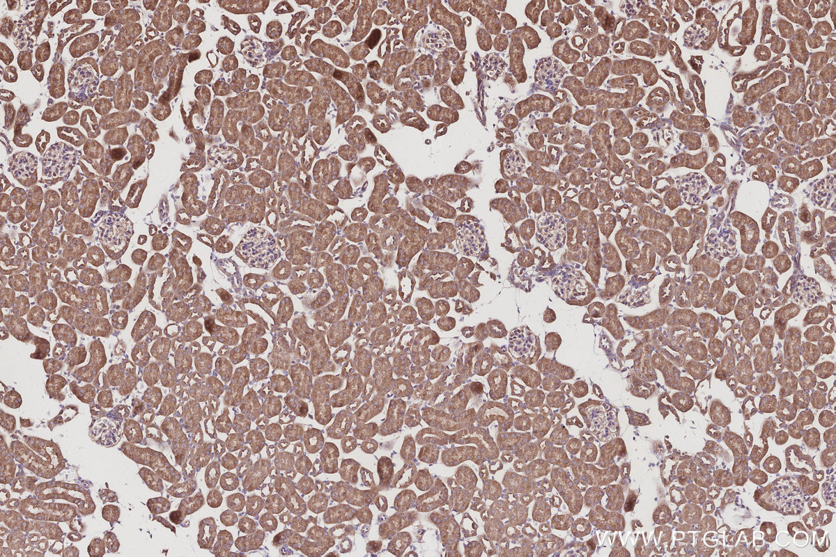 IHC staining of mouse kidney using 21856-1-AP IHC staining of mouse kidney using 21856-1-AP