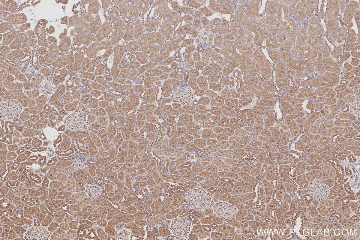 IHC staining of rat kidney using 21856-1-AP IHC staining of rat kidney using 21856-1-AP