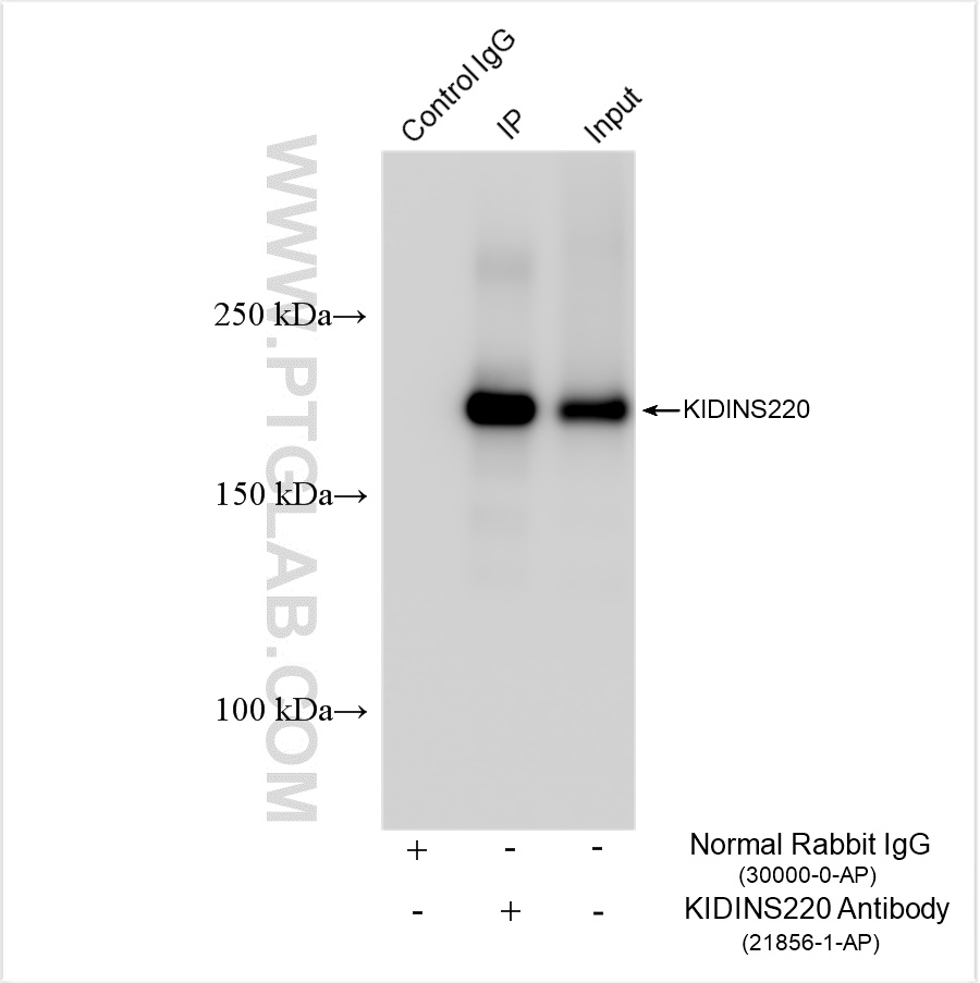 IP experiment of HEK-293 using 21856-1-AP