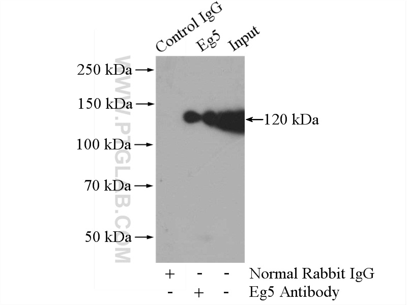 IP experiment of Raji using 23333-1-AP