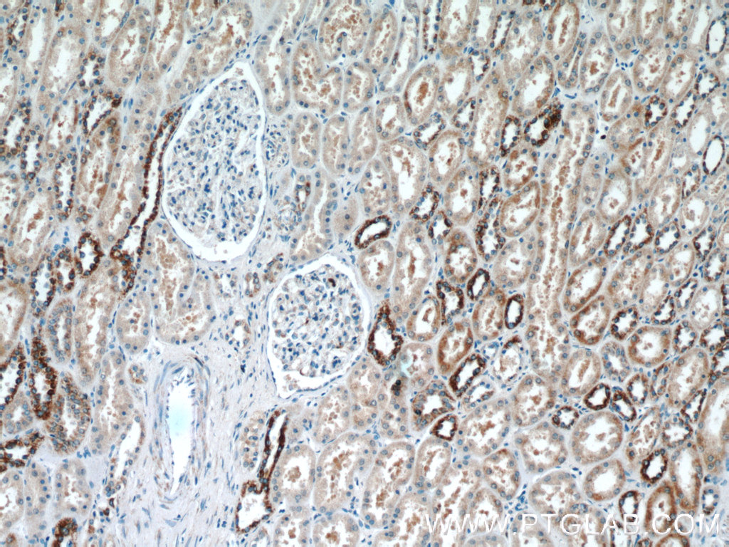 IHC staining of human kidney using 12035-1-AP