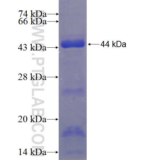 KIF12 fusion protein Ag23397 SDS-PAGE KIF12 fusion protein Ag23397 SDS-PAGE