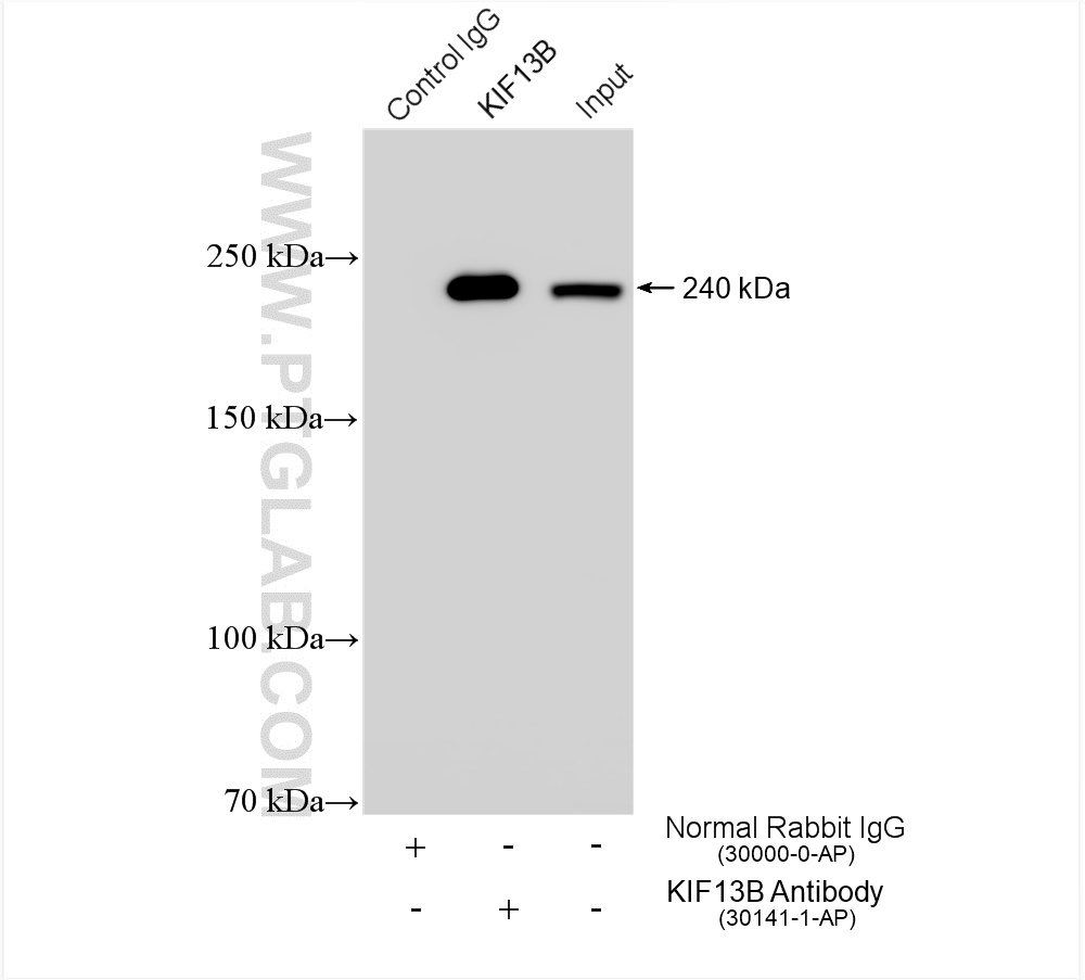 IP experiment of HEK-293 using 30141-1-AP