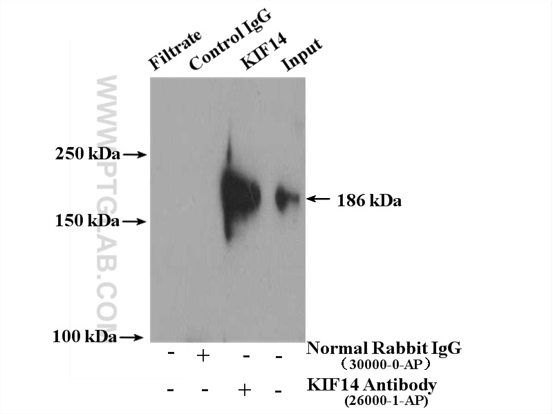 IP experiment of HEK-293T using 26000-1-AP