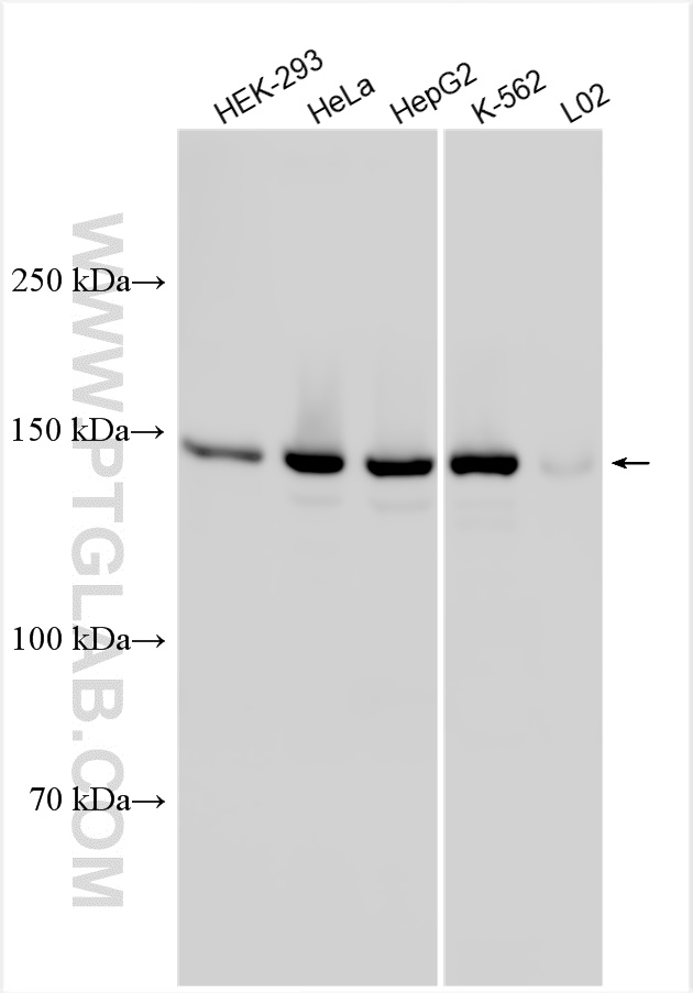 WB analysis using 30774-1-AP