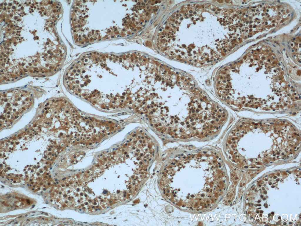 IHC staining of human testis using 55407-1-AP