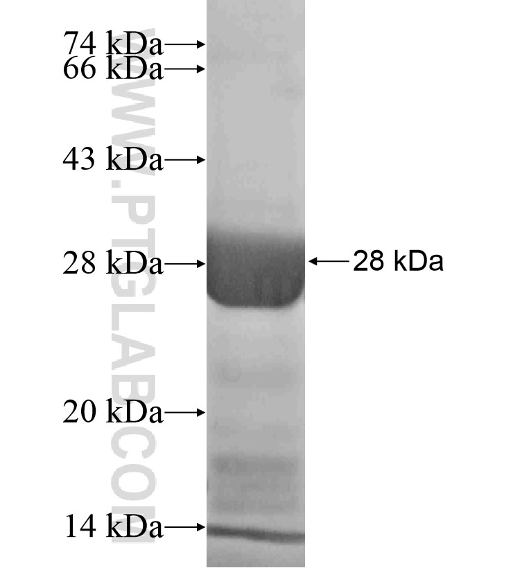 KIF16B fusion protein Ag18352 SDS-PAGE KIF16B fusion protein Ag18352 SDS-PAGE