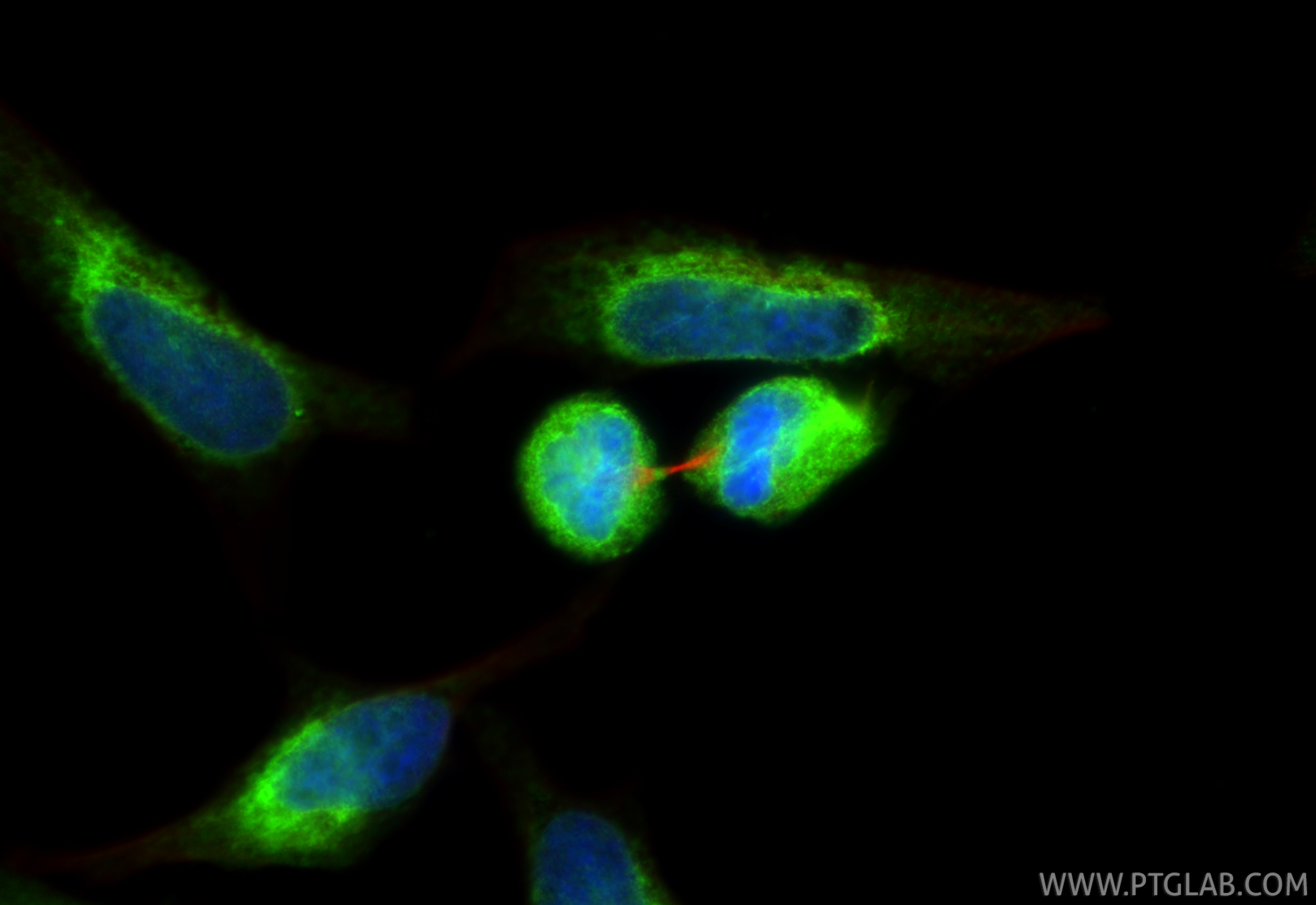 IF Staining of HeLa using 14615-1-AP