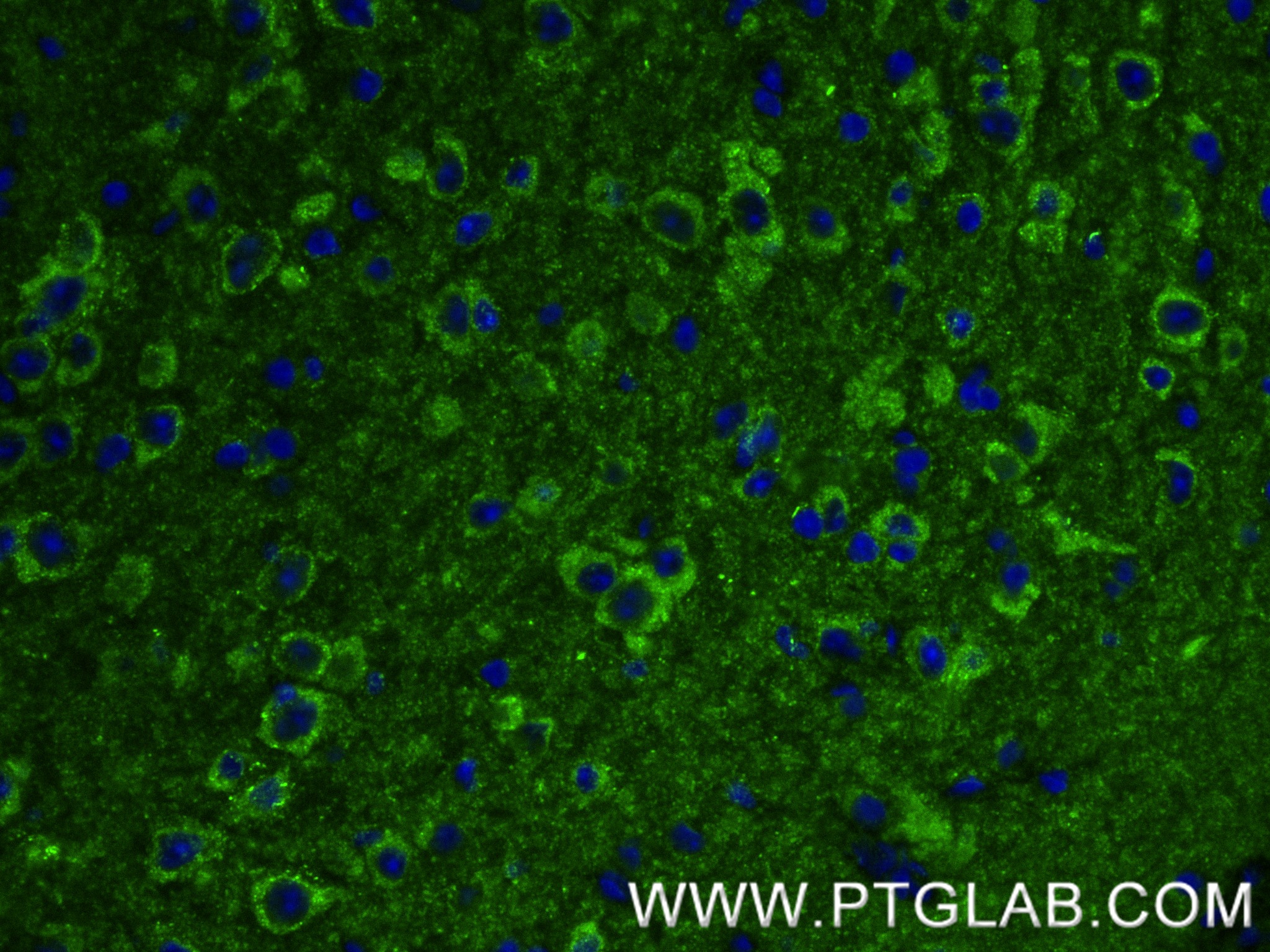 IF Staining of mouse brain using 85046-1-RR (same clone as 85046-1-PBS)