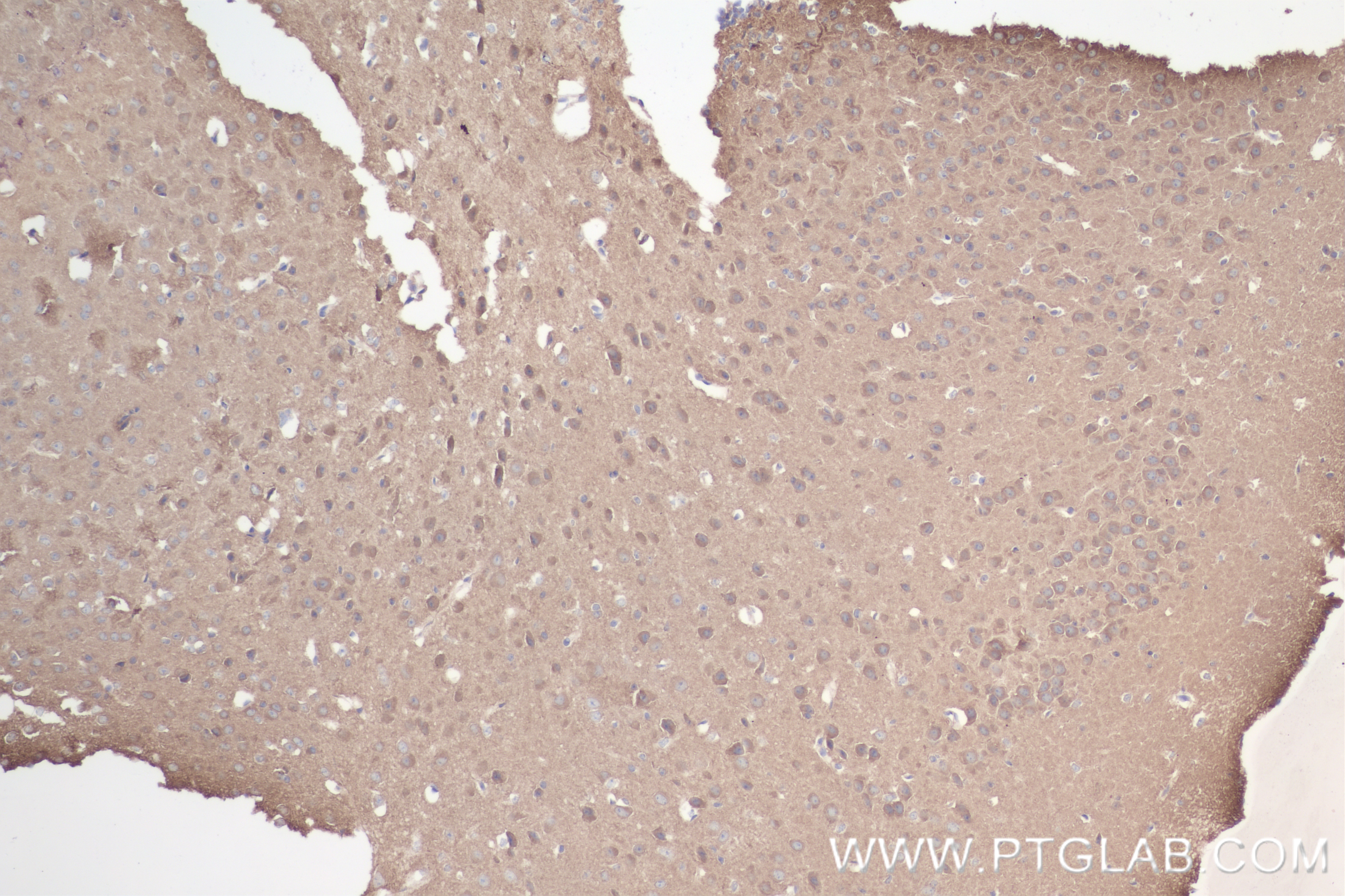 IHC staining of mouse brain using 85046-1-RR (same clone as 85046-1-PBS)