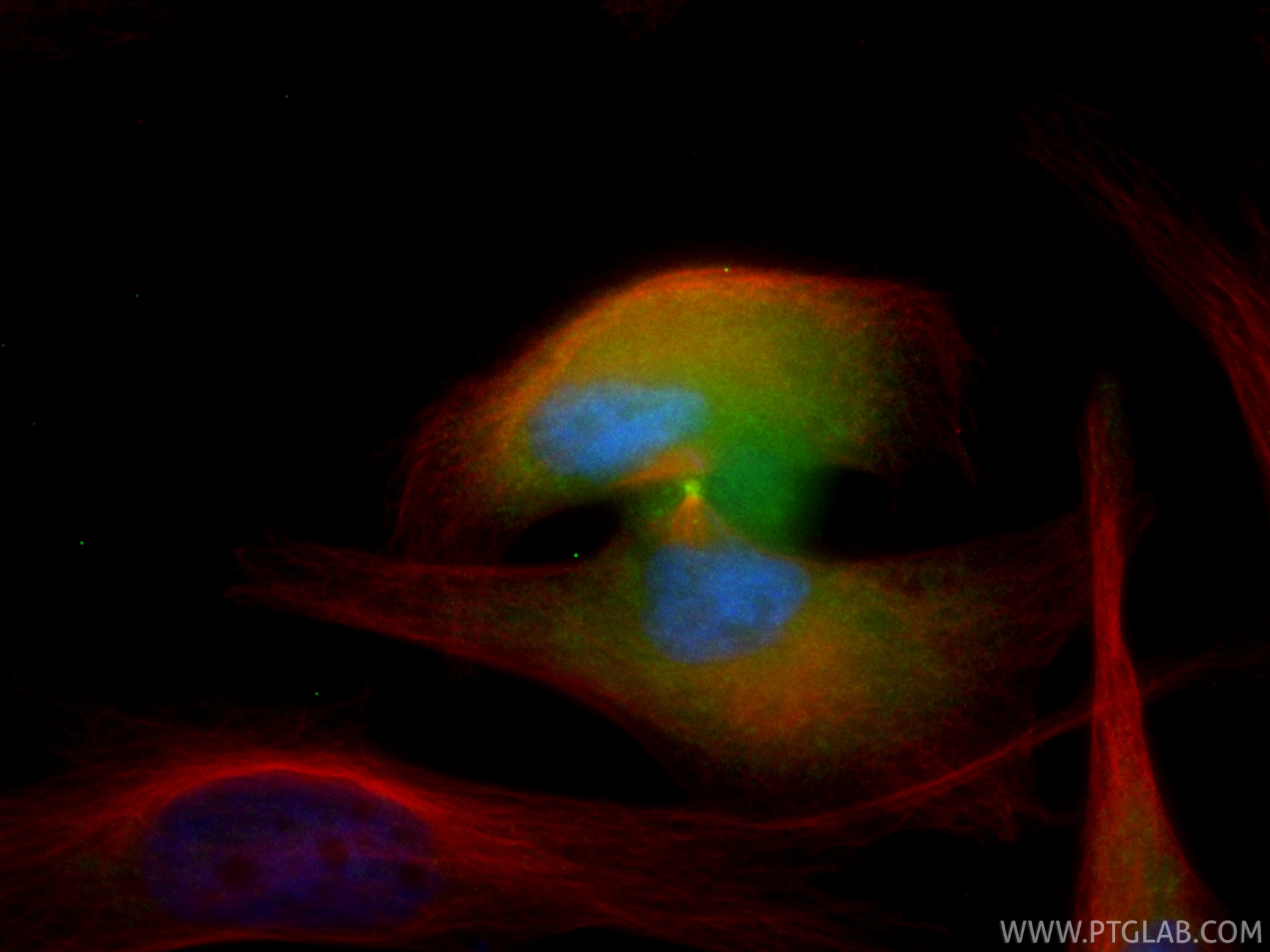 IF Staining of HeLa using CL488-85046