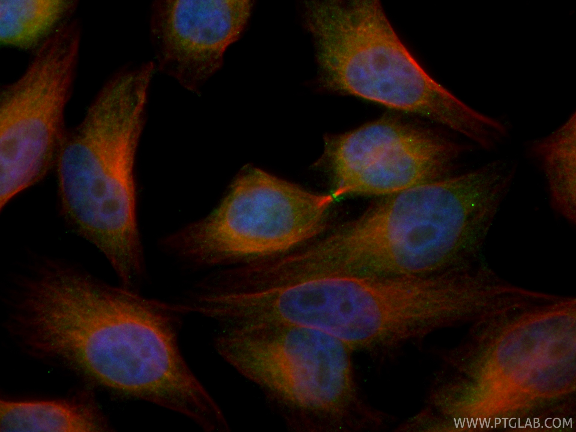 IF Staining of HepG2 using CL488-85046