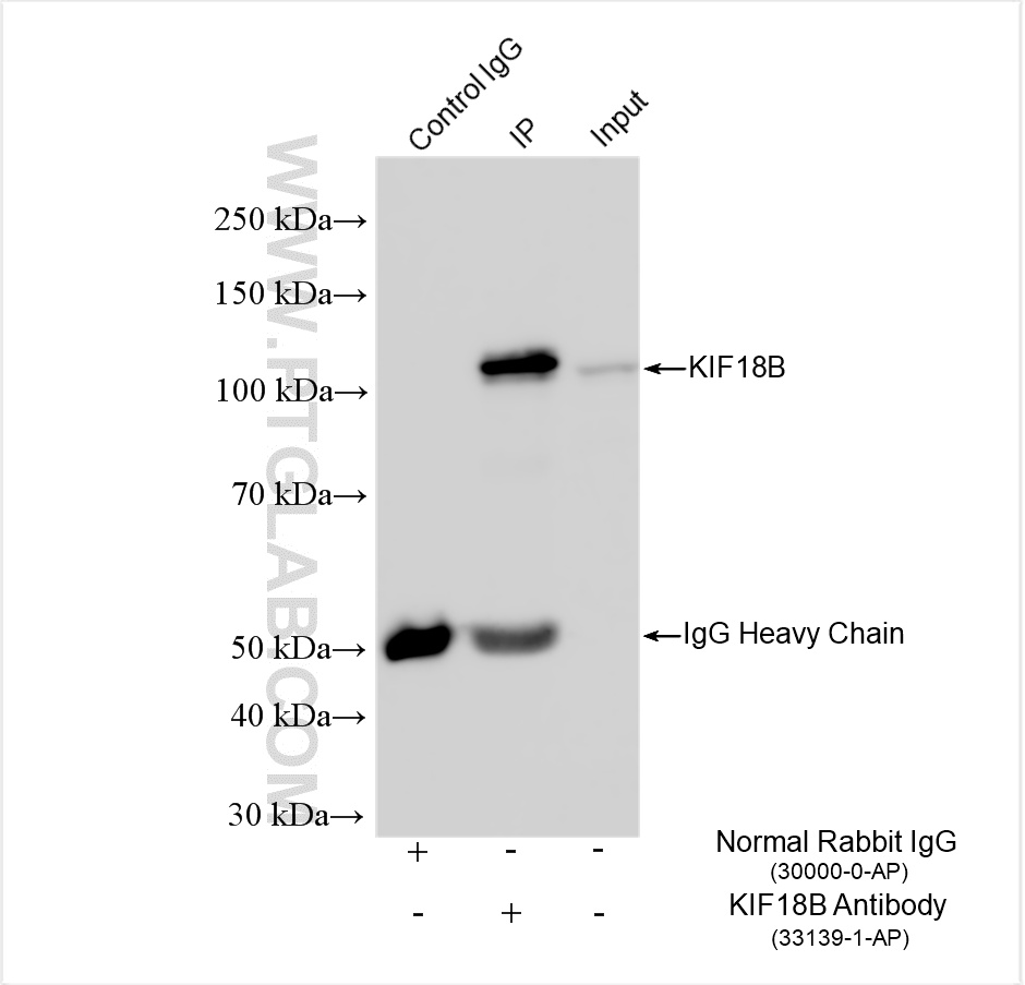 IP experiment of Jurkat using 33139-1-AP