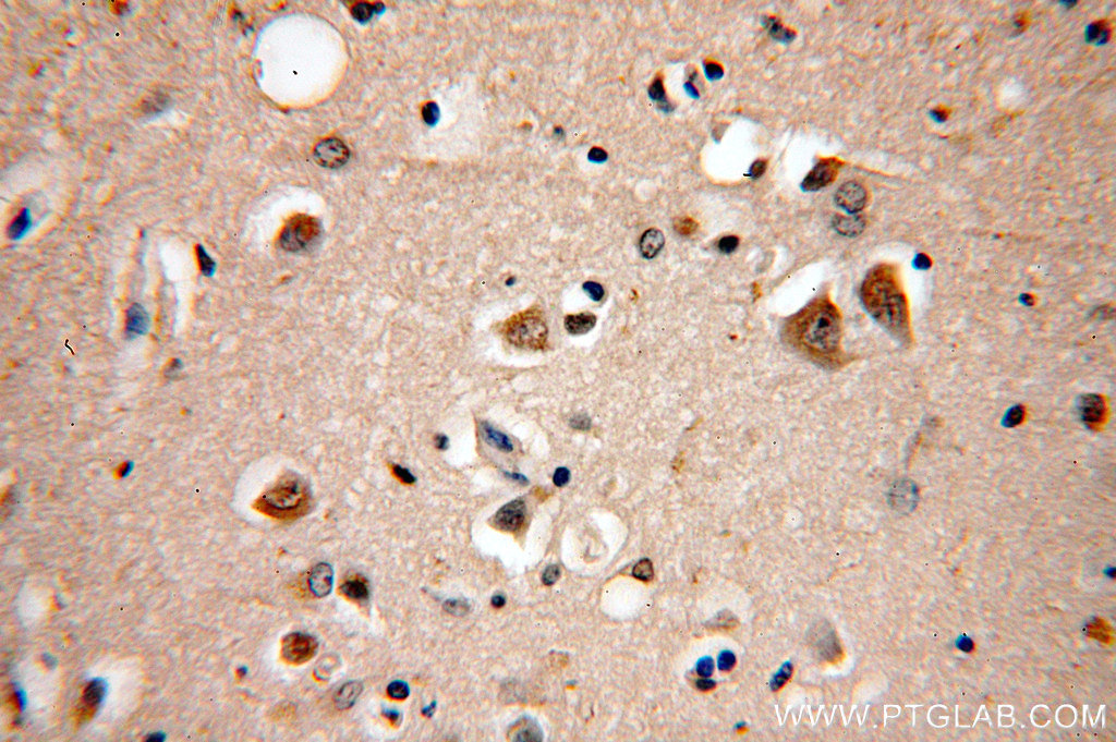 IHC staining of human brain using 19551-1-AP