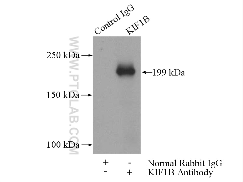 IP experiment of HeLa using 15263-1-AP