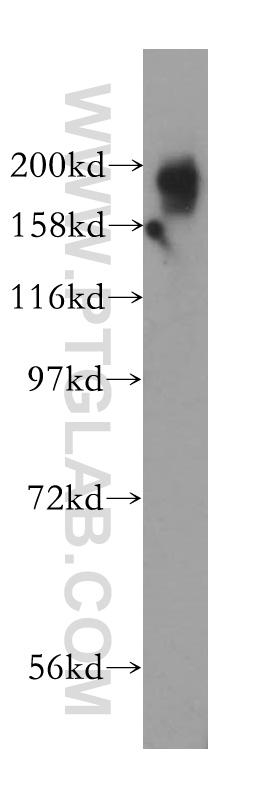 KIF1B Polyclonal antibody