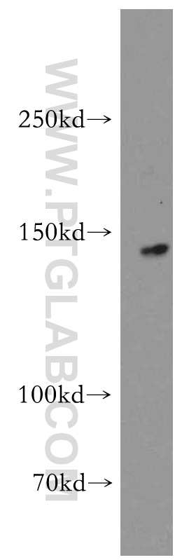 WB analysis of mouse heart using 12760-1-AP
