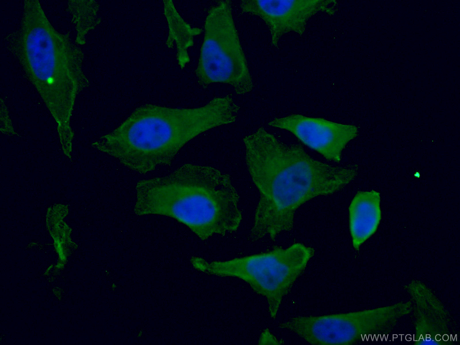 IF Staining of HeLa using 67190-1-Ig