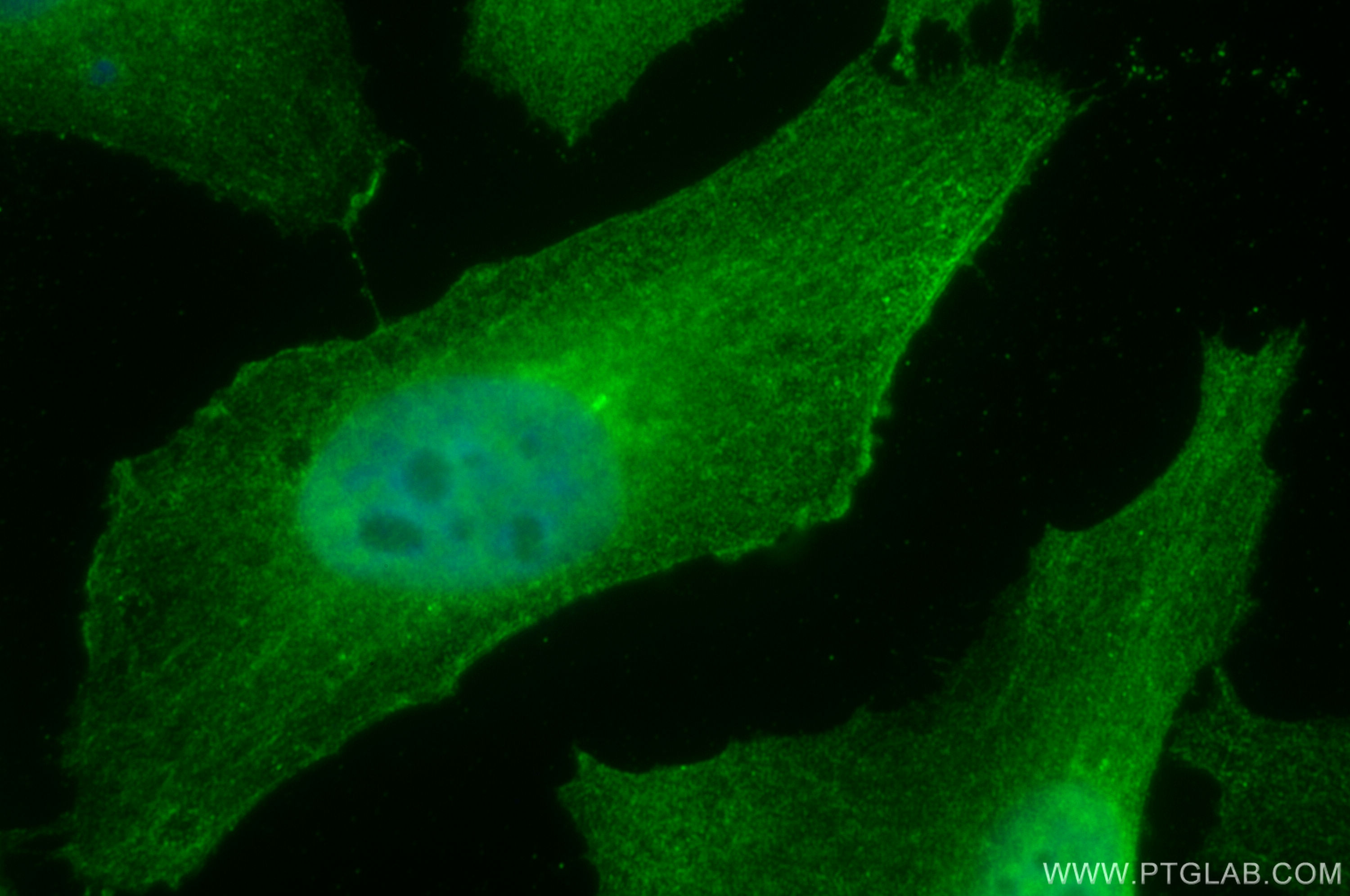 IF Staining of HeLa using 67190-1-Ig (same clone as 67190-1-PBS)