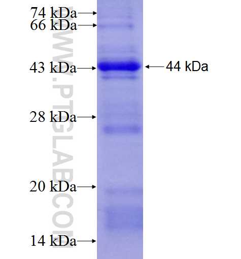 KIF20A fusion protein Ag8916 SDS-PAGE