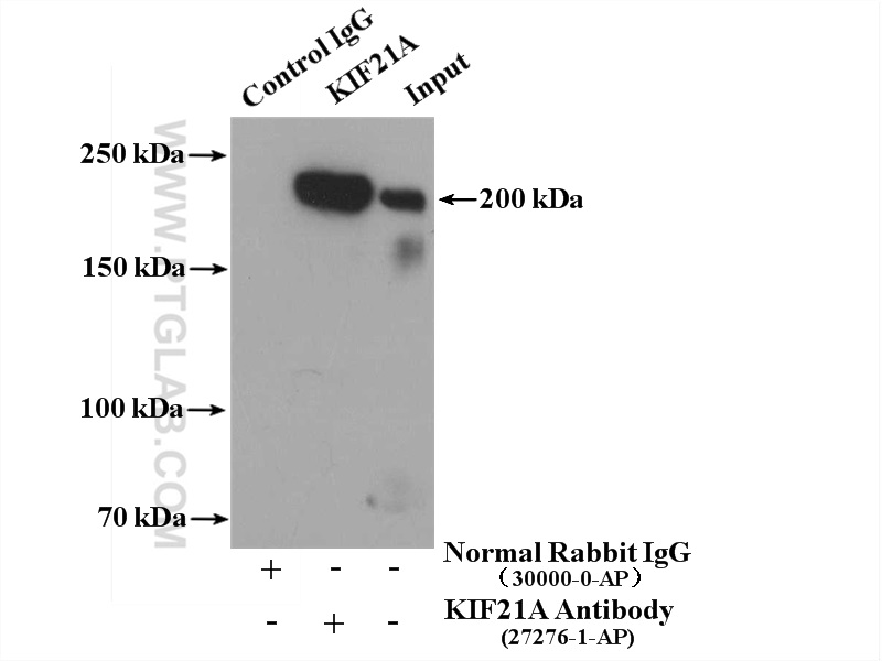 IP experiment of mouse brain using 27276-1-AP