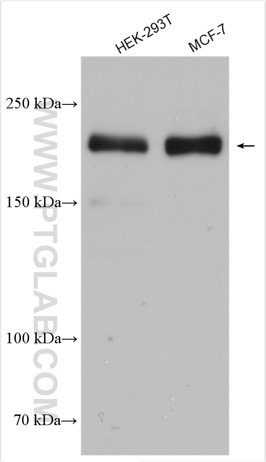 WB analysis using 27276-1-AP