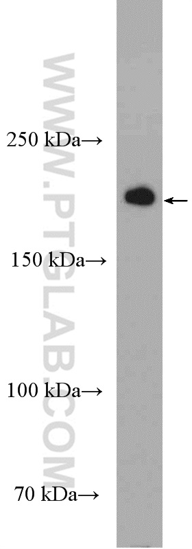 WB analysis of mouse brain using 27276-1-AP