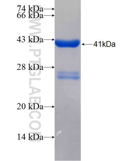 KIF21A fusion protein Ag26192 SDS-PAGE KIF21A fusion protein Ag26192 SDS-PAGE