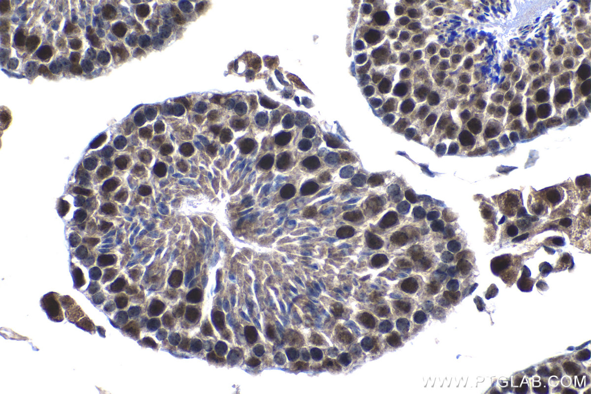 IHC staining of mouse testis using 13403-1-AP