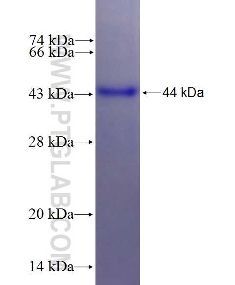 KIF22 fusion protein Ag26862 SDS-PAGE