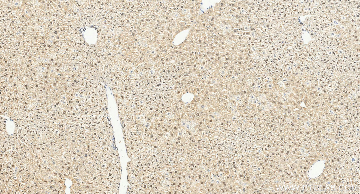 IHC staining of mouse liver using 28587-1-AP IHC staining of mouse liver using 28587-1-AP