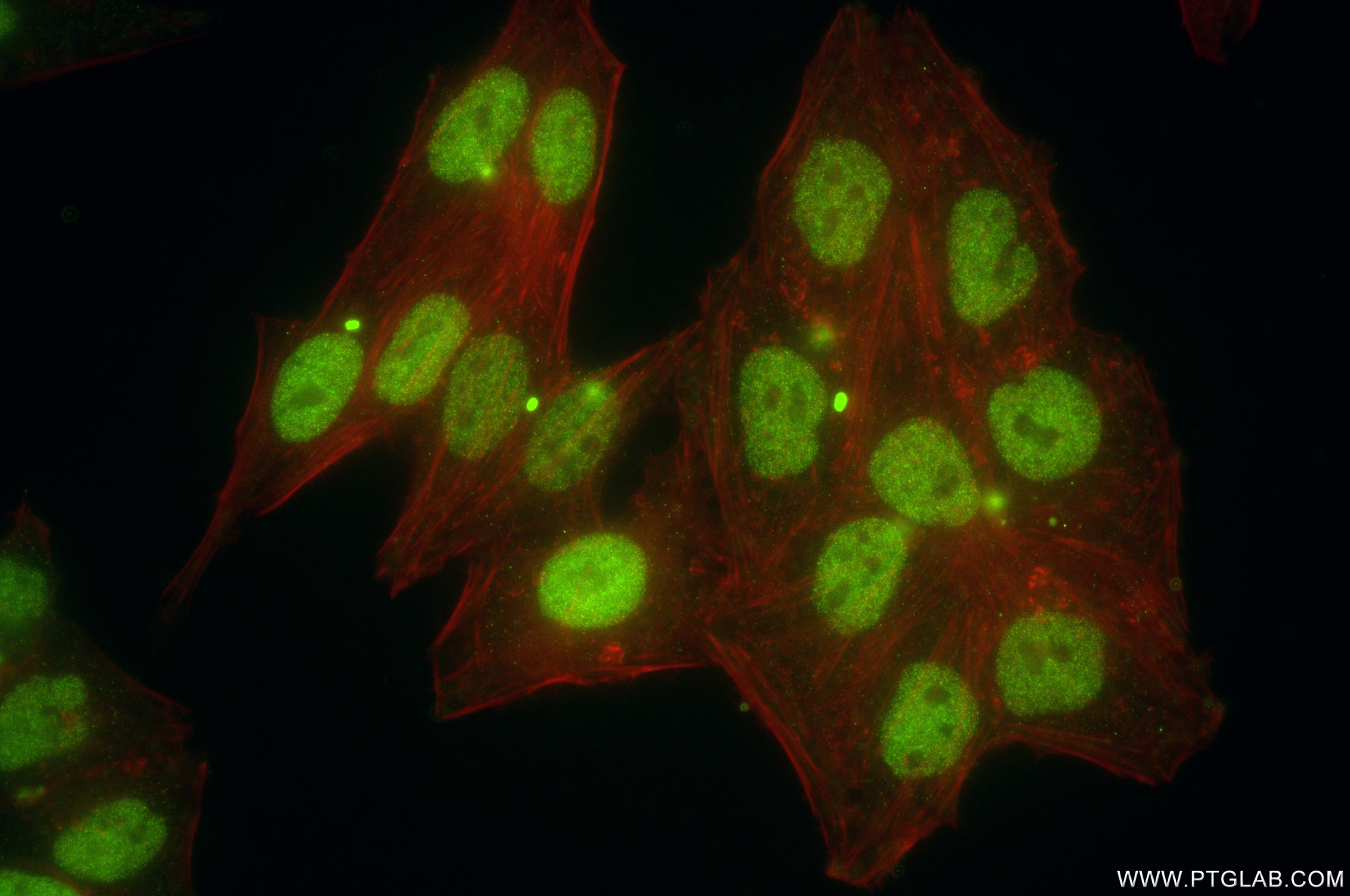 IF Staining of HepG2 using 85675-5-RR (same clone as 85675-5-PBS)