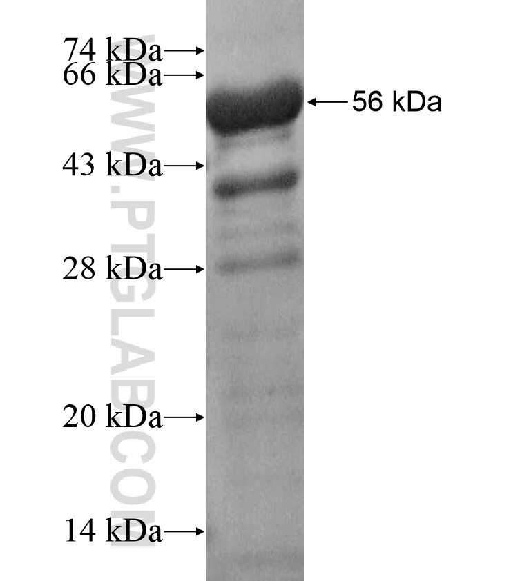 KIF24 fusion protein Ag17499 SDS-PAGE KIF24 fusion protein Ag17499 SDS-PAGE