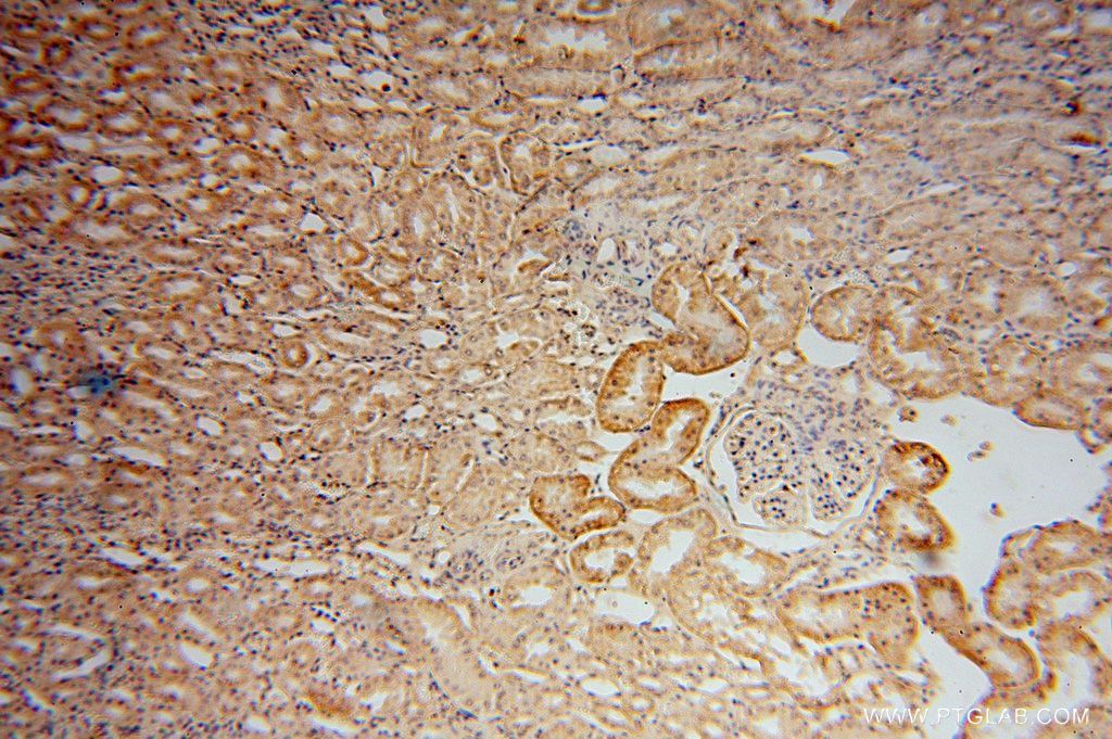 IHC staining of human kidney using 17422-1-AP