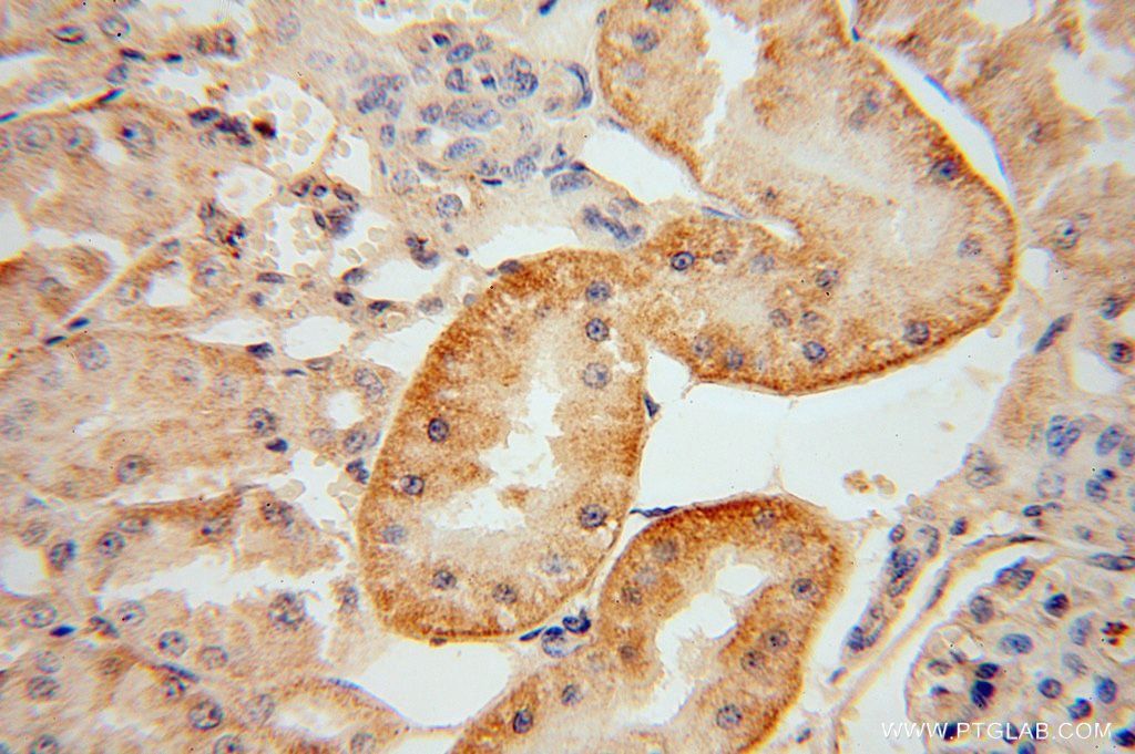 IHC staining of human kidney using 17422-1-AP