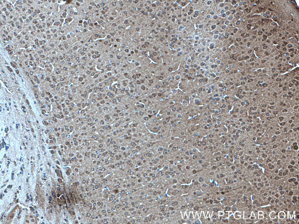 IHC staining of mouse brain using 27218-1-AP