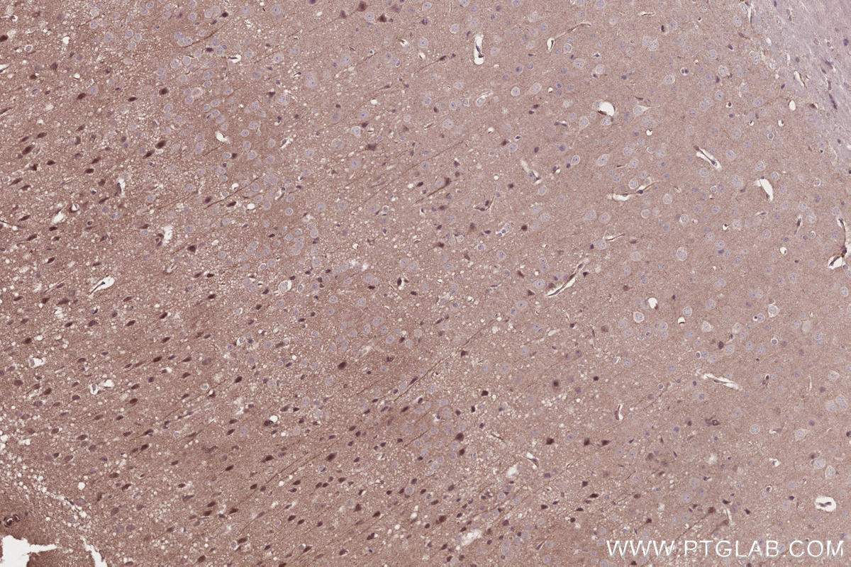 IHC staining of mouse brain using 13711-1-AP IHC staining of mouse brain using 13711-1-AP