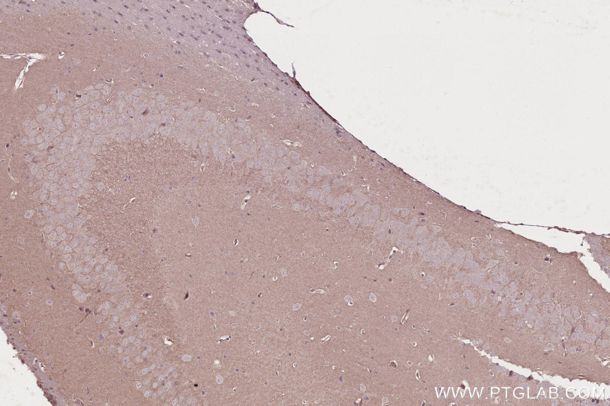 IHC staining of mouse brain using 13711-1-AP IHC staining of mouse brain using 13711-1-AP