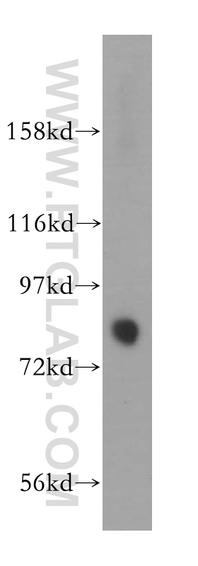 WB analysis of mouse brain using 13711-1-AP