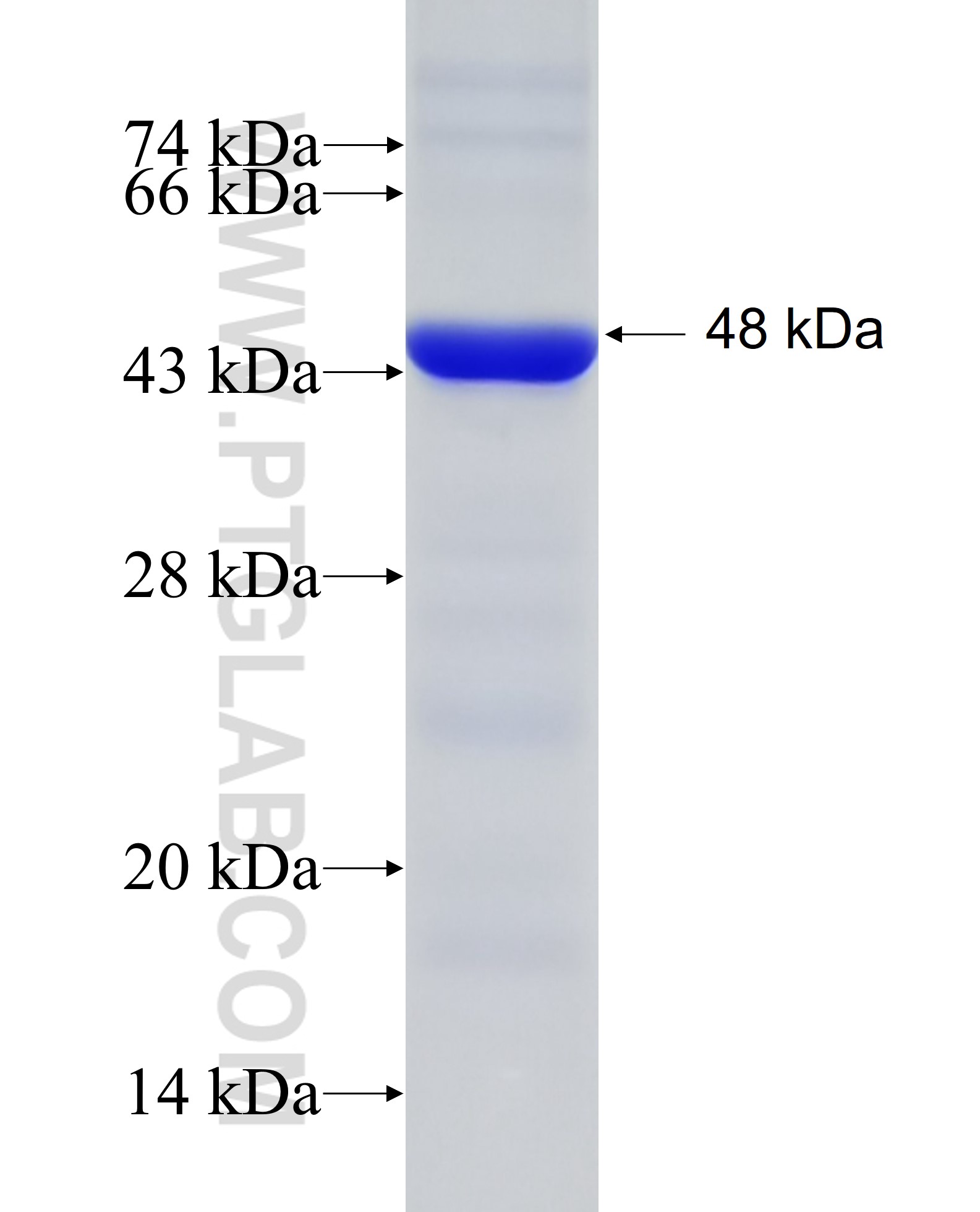 KIF2B fusion protein Ag28069 SDS-PAGE KIF2B fusion protein Ag28069 SDS-PAGE