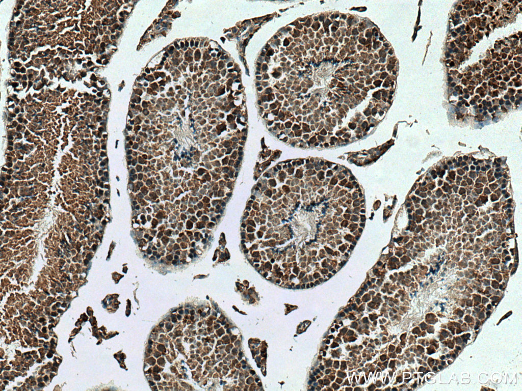 IHC staining of mouse testis using 28372-1-AP