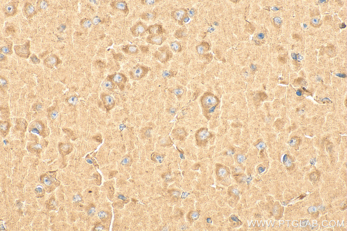 IHC staining of mouse brain using 13930-1-AP