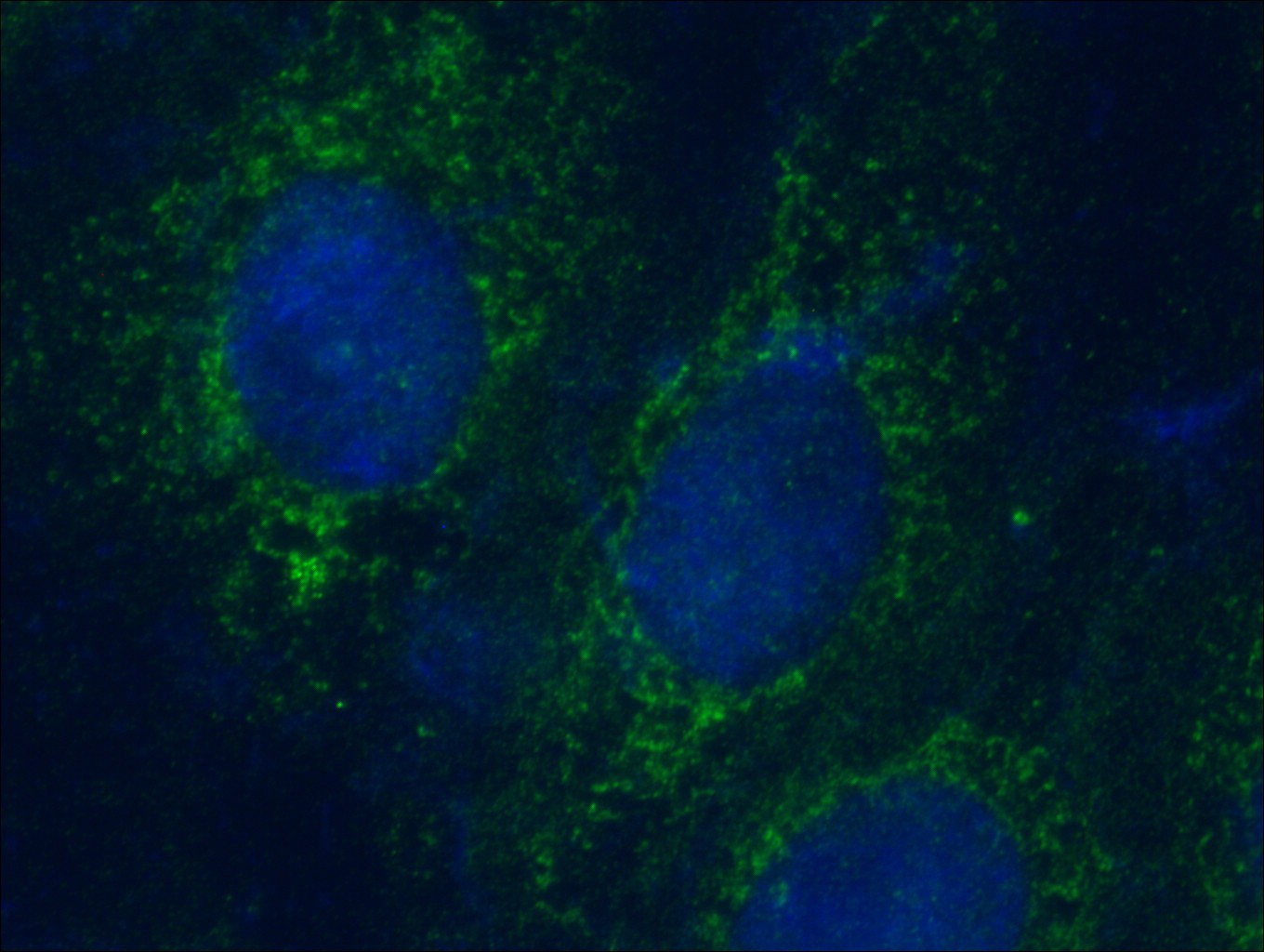 IF Staining of SH-SY5Y using 14333-1-AP