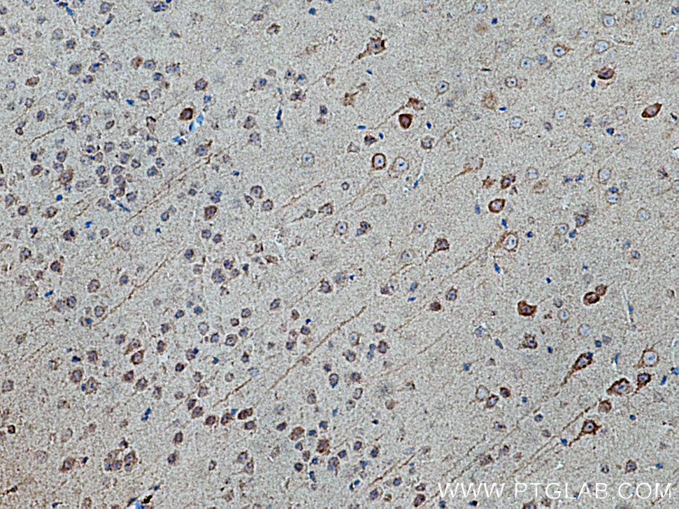 IHC staining of mouse brain using 21186-1-AP